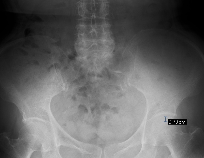 骨盤 仙腸関節 の治療 診療メニュー いでの整形外科リウマチ科クリニック