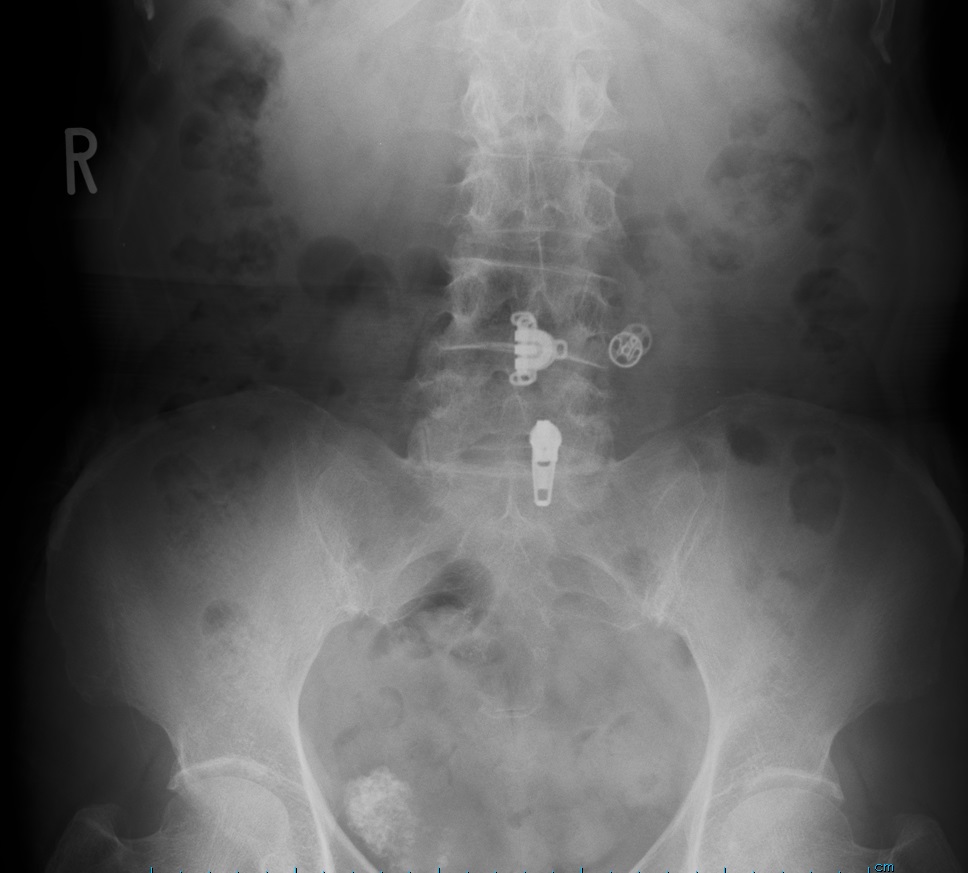 骨盤 仙腸関節 の治療 診療メニュー いでの整形外科リウマチ科クリニック